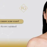 What causes acne scars