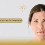 best laser for pigmentation