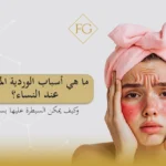 أسباب الوردية المفاجئة عند النساء