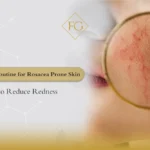 routine for rosacea prone skin