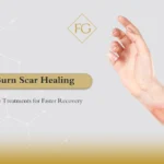 burn scar healing