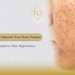 smooth acne scars texture