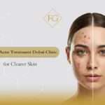 laser acne treatment Dubai clinic