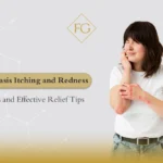 psoriasis itching and redness