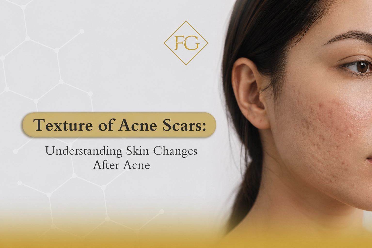 texture of acne scars