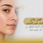 أفضل علاج لندبات حب الشباب