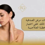 درجات مرض الصدفية