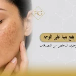 ظهور بقع بنية على الوجه