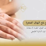 علاج بقع البهاق الصغيرة