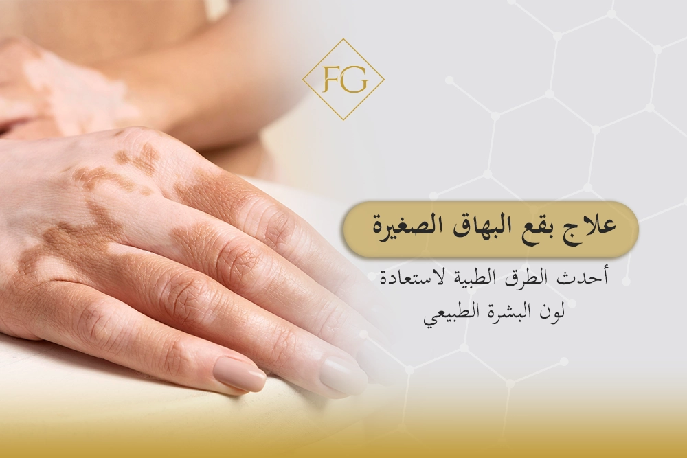 علاج بقع البهاق الصغيرة