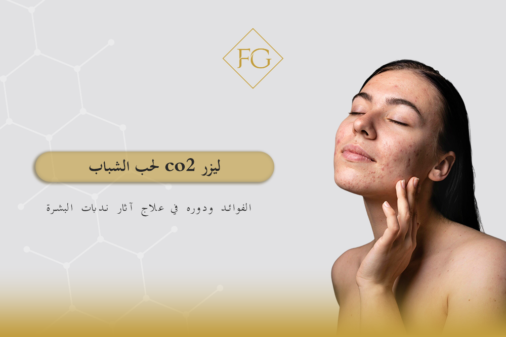 ليزر co2 لحب الشباب