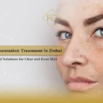 pigmentation treatment laser Dubai