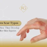 Burn scar types
