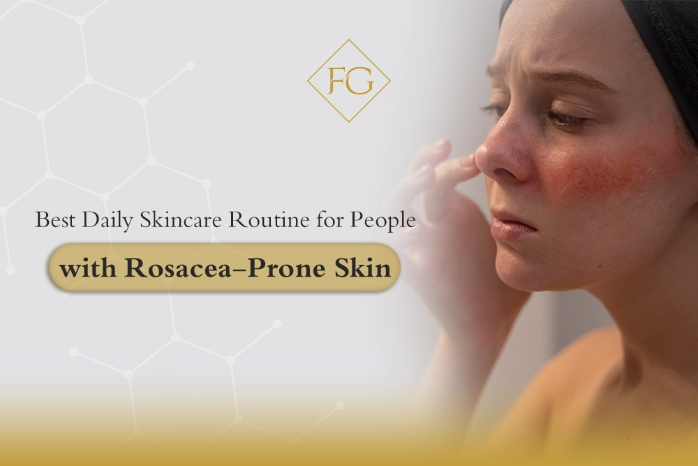 Rosacea-Prone Skin