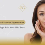 Chemical Peels for Pigmentation