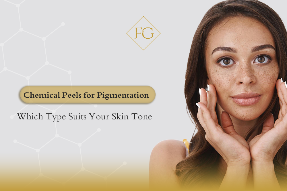 Chemical Peels for Pigmentation