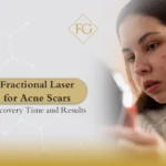Fractional Laser for Acne Scars