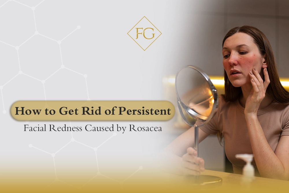 Persistent Facial Redness