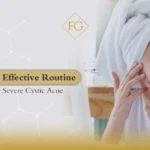 Severe Cystic Acne