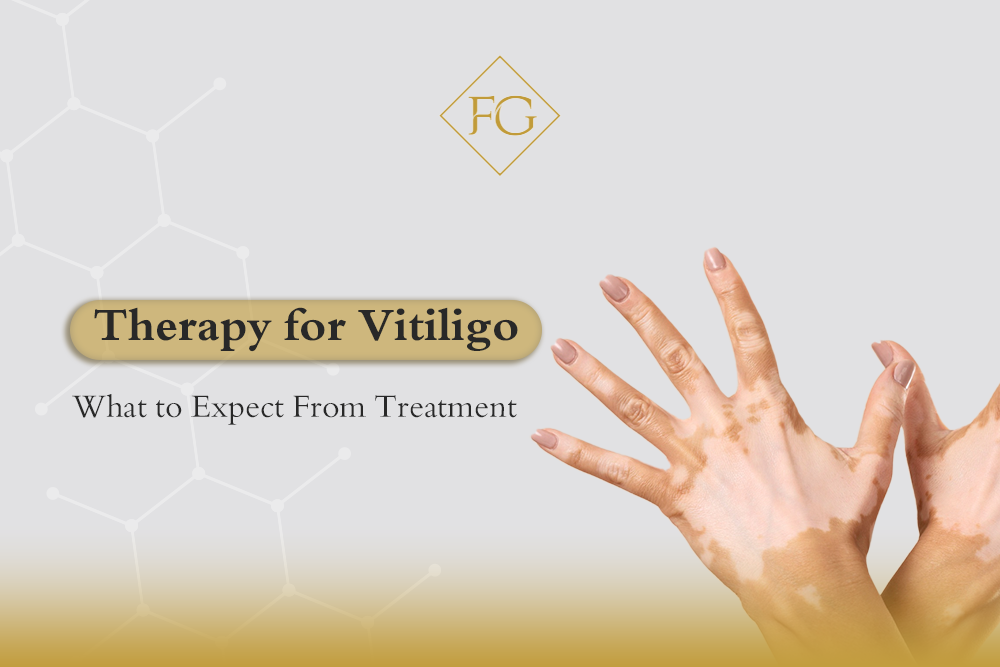 Therapy for Vitiligo