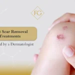 best scar removal treatments