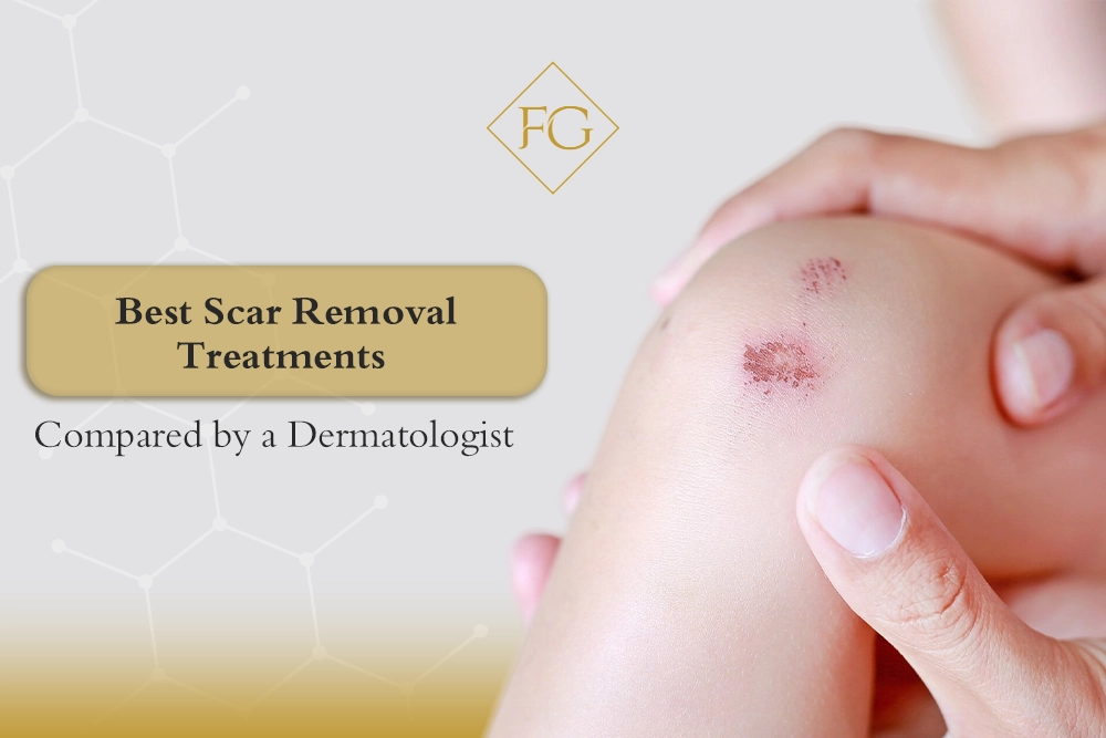 best scar removal treatments