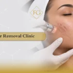 scar removal clinic