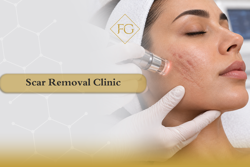 scar removal clinic