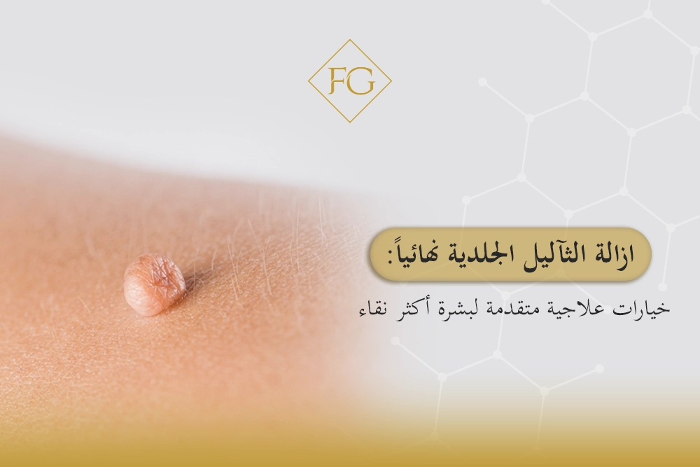 ازالة الثآليل الجلدية نهائيا