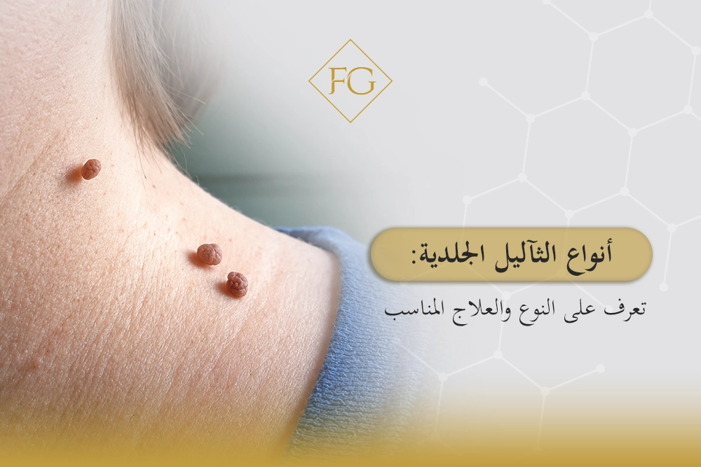 انواع الثآليل الجلدية