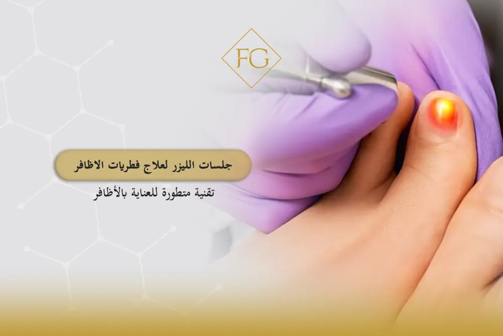 جلسات الليزر لعلاج فطريات الاظافر