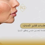 جلسات تقشير الندبات