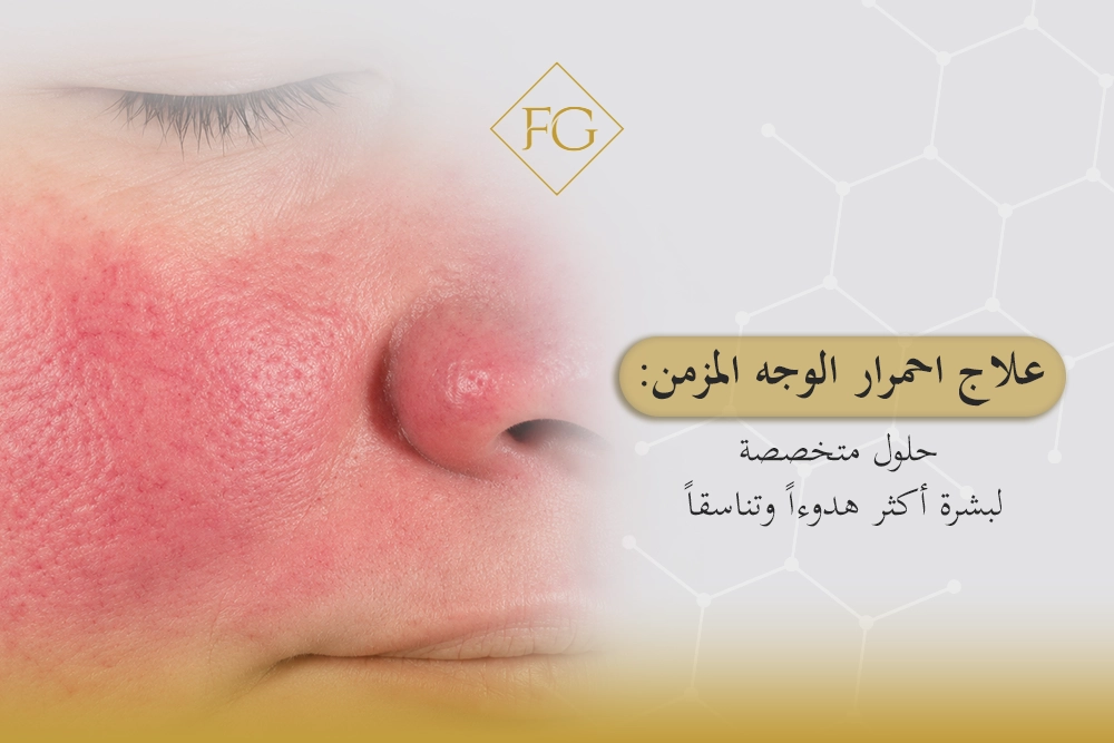علاج احمرار الوجه