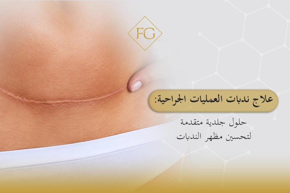 علاج ندبات العمليات الجراحية